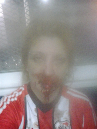 Illustration for article titled Argentine Woman Says She Was Brutally Beaten For Wearing Soccer Jersey